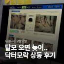안경닥터 | 닥터모락 상동｜부천시청역 두피케어 가서 탈모 발견한 후기(가격·비용·주차)