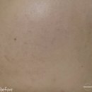 채움기프트 | (올리브영 1위) 탄력 집중 케어, 메디힐 하이퍼 콜라겐 겔 마스크 후기