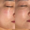 평택 피부관리 이중턱 윤곽관리 추천 &lt;유하이 뷰티앤바디&gt;