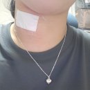 목뉴방외과의원 | 갑상선종 치료 이야기
