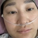 속전 | 삼중음성 항암 8차후 속전절제(피부보존) 및 확장기 수술후기 (수술 직전 MRI결과까지….)