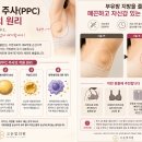 고운빛의원 티스토리