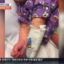 영국에서만 100명, 코로나 관련 의심 어린이 괴질 확산 이미지