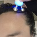 한화 송파지점 | 야구선수 단골 송파 두피관리 탈모관리는?? 하루두피 송파역점