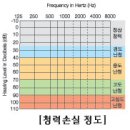 난청,이명,보청기 이미지