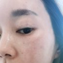 뷰티라운지의원 | 일요일에도 하는 피부과/고덕 뷰티라운지 의원