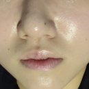 탈모락바이피부수작 네이버블로그