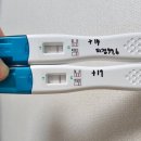 수정-51 | 💉 시험관 1차 시술 후기 — 인공수정 실패부터 화학적 유산까지