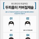 모반개발