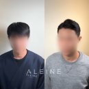 알렌느헤어 이미지