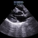 CKD 고양이에서 NT-proBNP수치와 심장병 유무에 대한 추가 케이스. 이미지