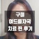 진 | [구미여드름자국 치료] 한의원에서 울긋불긋함 모두 좋아진 후기