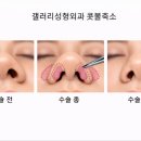 갤러리성형외과의원 이미지