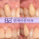 연세바른치과 이미지