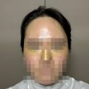 비타프렙 | 다이소 화장품 후기 2탄 : 본셉 비타씨 동결건조 더블샷 앰플, SNP 프렙 비타로닉 아이패치