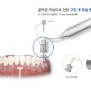 이노바이오써지 이미지