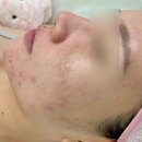 더쥬아 | 이태원피부관리, 리베룩관리 뷔쥬아왁싱&amp;더멜라닌 솔직후기