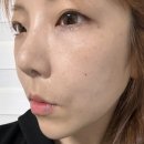 씨에스디바 | 바쿠나 CSV LT 앰플 에스테틱 화장품 피부관리실 화장품으로 셀프 홈케어