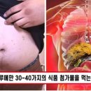 “혈관이 폭발하기 직전..” 값싼 편의점 도시락 매일 사먹은 20대 청년의 건강검진 결과 매우 충격적입니다. 이미지