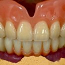 리더스기공소 이미지