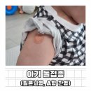 12개월 아기 돌접종 종류, 시기, 순서와 접종열 및 후기