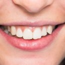 베네치아치과교정과치과의원 이미지