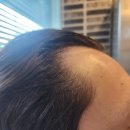 이루다스칼프