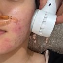 초석빌딩 | 대구여드름관리 피부두피탈모전문 미모에스테틱 여드름 진정 재생관리 후기