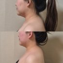 리턴 | 창원 윤곽관리 리턴에스테틱 내돈내산 만족 후기