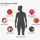 자궁경부암 초기증상 및 원인 예방접종 이미지