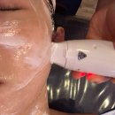 평택피부관리 써마지 고주파 &amp; 플라즈마 후기 봄날 에스테틱