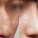 별성형외과