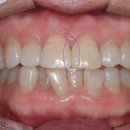 네츄럴치과기공소 이미지