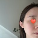 튠페이스 두번째, 스킨보톡스 후기/광교 바이킴 피부과(내돈내산)