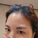 (주)라인에너지 고양 | 풍동피부관리 허니에스테틱 에서 고주파 리프팅으로 피부 진정 얼굴 비대칭 잡고 왔어요.