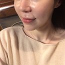 금강카클리닉 | 봉천역피부관리 / 상도동피부관리 드림스킨 두번째 방문