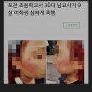 30대교사 초등생 폭행사건 이미지