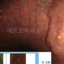 메트로속내과의원 이미지