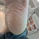 브레댄코산본점(센트로601) | 산본 군포 발각질 한 번만 받아도 달라지는 관리 오벨리네일푸스 족보있는그녀들 군포산본점