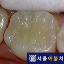 서울예봄치과 이미지