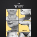 HEJN 턱살,팔뚝살,뱃살 순삭! 이펙트라 메딕쉐이퍼 프리뷰.