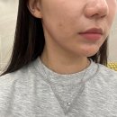사진빨 | 안면비대칭 교정 고주파사각턱보톡스 심부볼주사 받은 후기 - 사진빨 안받는 얼굴 들어오세용