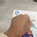 린스몰제주점 | 아토피·비염·천식 면역치료 10차 후기 : 히스토불린 주사 효과와 아카리작스 병행 기록