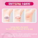 농산물 품질 관리사 양성과정(30세이상) | 유방암 초기 증상과 치료 방법