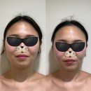 예가 | 대전 신부관리 탄방동 도인예가에스테틱 예마지 후기