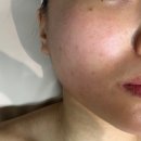 서면피부관리 가봄 에스테틱 - 리프팅 윤곽 관리 후기