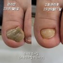 손꽃네일 이미지