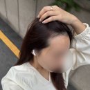 강남-215 | 강남 신사 헤어라인 커버 맛집 찐만족 후기