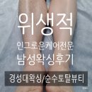 [순수토탈뷰티] 경성대부경대 바디프로필왁싱/인그로운 케어전문 /남성 종아리왁싱후기