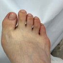 아픈 내성발톱 탈출 도와주는 레푸스 전주혁신점 방문후기